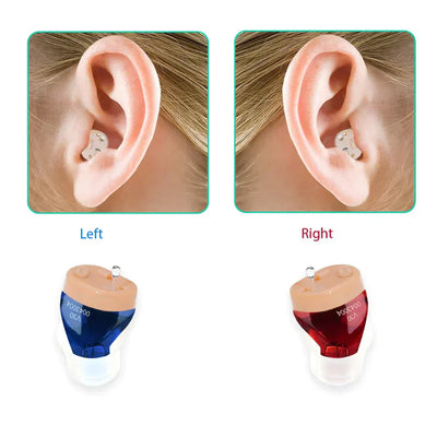 Luxevil In-Ear Hearing Aids – Rechargeable and Invisible